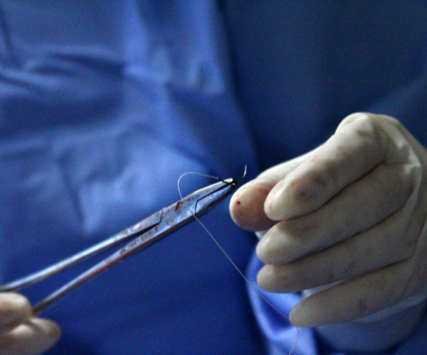 Chirurgia Ginecologica: